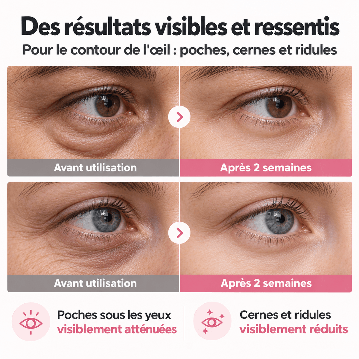 Patchs yeux Collagène & PDRN